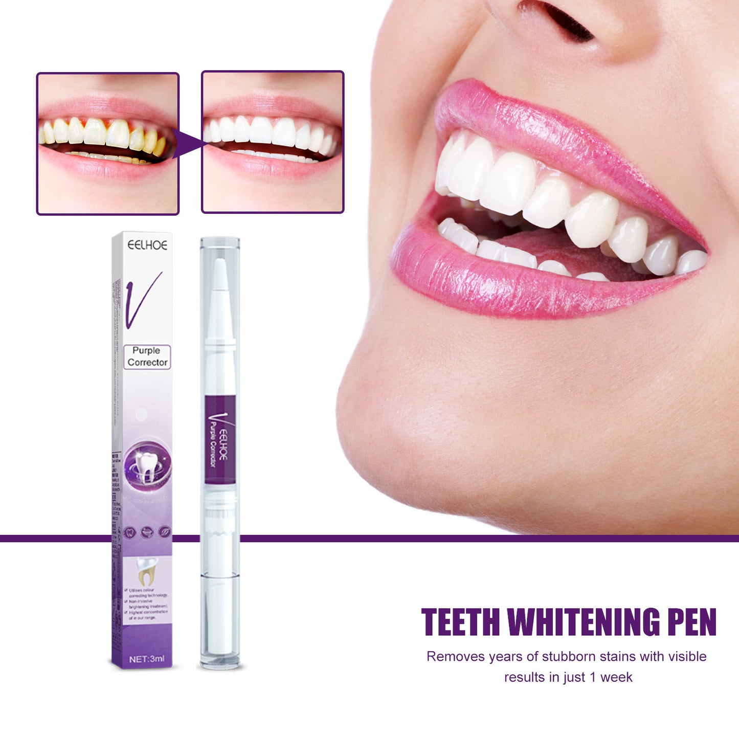 V34 Purple Dental Pen Oral Cleaning, Removing Stains And Brightening